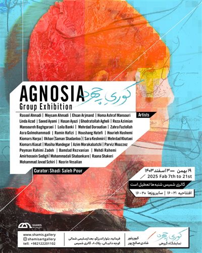 Agnosia