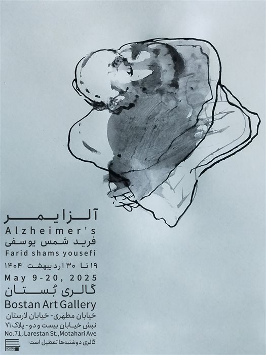 آلزایمر